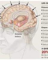 Como mantener el cerebro en forma para alejar al alzheimer